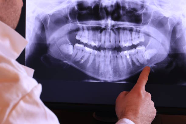 Best Emergency Root Canal Treatment in Madison, NC