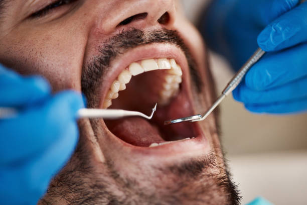 Best Pediatric Emergency Dentist in Madison, NC