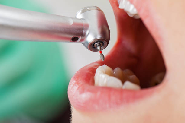 Best Same-Day Emergency Dentist in Madison, NC
